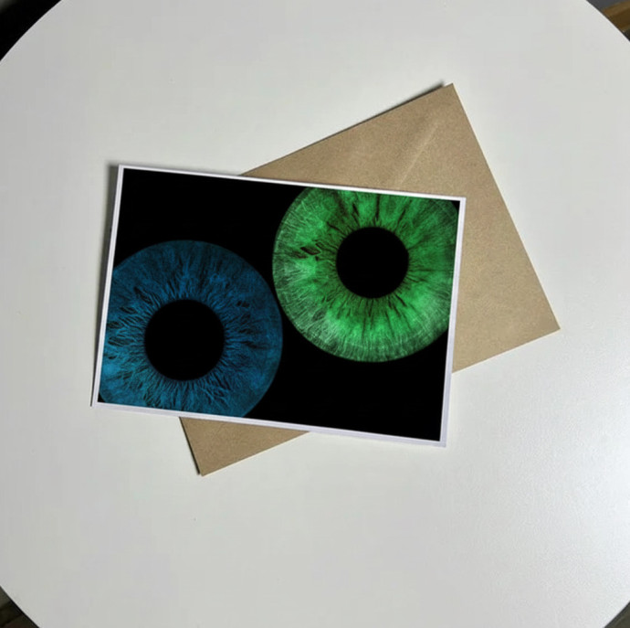 Парное фото радужки глаз в Балашихе (в Москве)