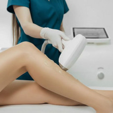 Лазерная эпиляция в Москве