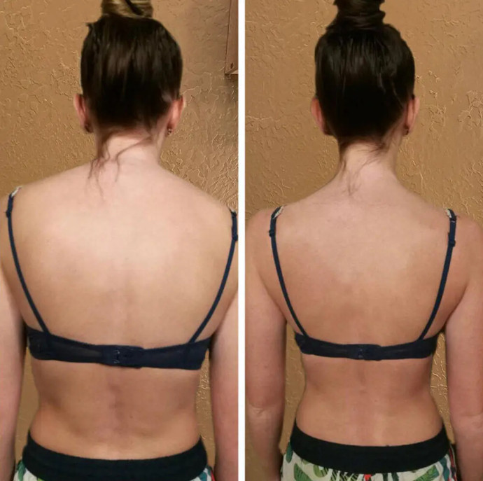 Лечебный массаж спины и шеи в Москве