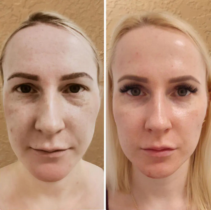 Скульптурно буккальный массаж лица в Москве